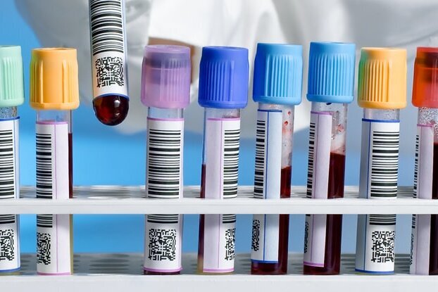 Meerdere laborbuizen met barcode etiketten, in een tray, beeldmotief voor ronde verlijming, liggend formaat.